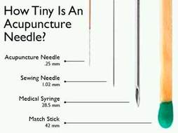 how tiny is an acupuncture needle