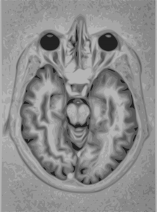 446px-Brain_Mri_nevit.svg