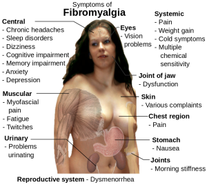 800px-Fibromyalgia_symptoms.svg