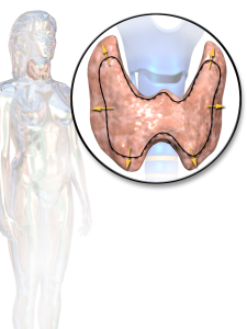 Blausen_0534_Goiter