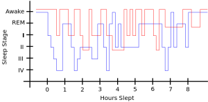 710px-RLS_sleep_patterns_diagram_-_en.svg