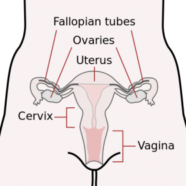 Acupuncture and Herbs Clear Fallopian Obstruction Infertility