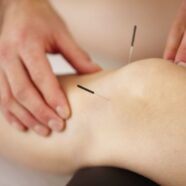 Acupuncture After Knee Replacement Surgery