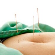 Acupuncture Eases Endometriosis Pain