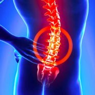 Acupuncture for Lumbar Disc Herniations
